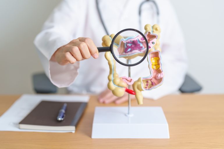 大腸がんの予兆とは？ 人間ドックを活用した早期発見のメリット