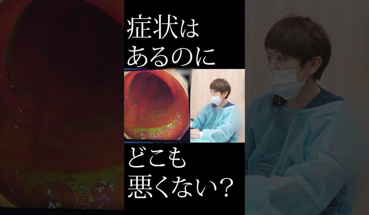 便秘やお腹の痛みに悩みながら検査で異常がなかった患者様のリアルな声を紹介