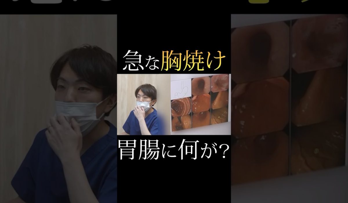 突然の胸焼けに不安を感じて検査を受けた患者様のリアルな声を紹介