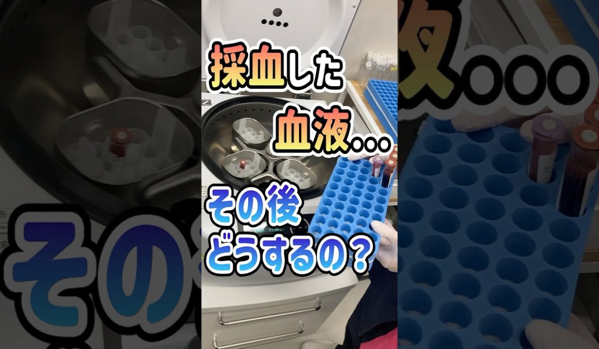 採血後の血液の扱いや検査内容に驚いた患者様のリアルな声を紹介