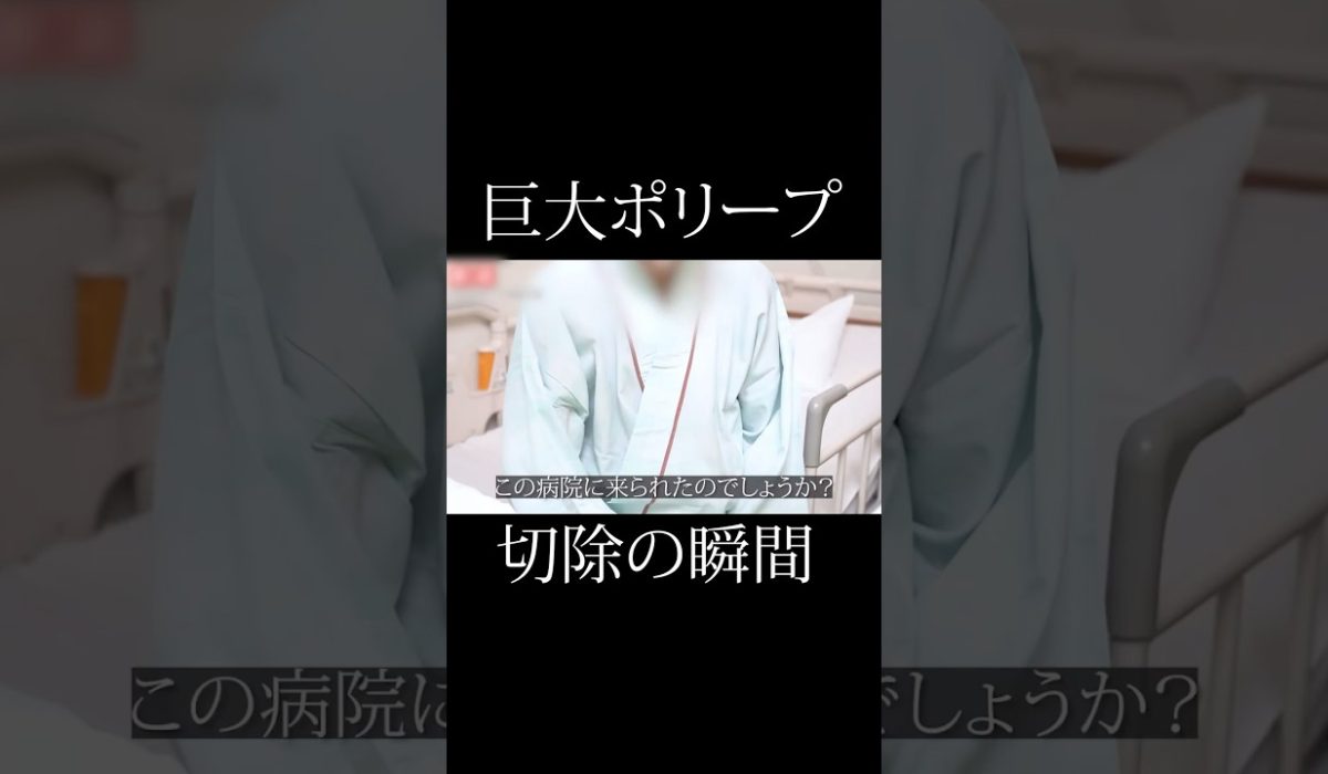 巨大なポリープをその場で切除された患者様のリアルな声を紹介