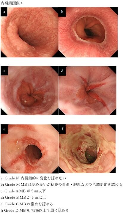 実際の内視鏡画像