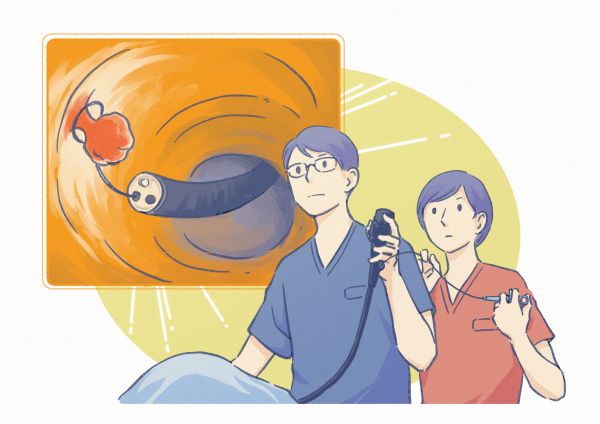 ポリープ切除を行う医師と内視鏡映像のイラスト