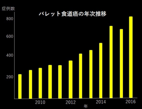 逆流性食道炎とバレットがん