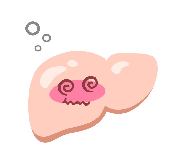 脂肪肝