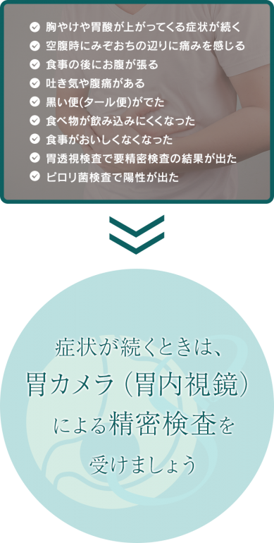 症状が続くときは、胃カメラ（胃内視鏡）による精密検査を受けましょう