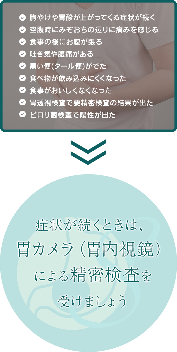 症状が続くときは、胃カメラ（胃内視鏡）による精密検査を受けましょう