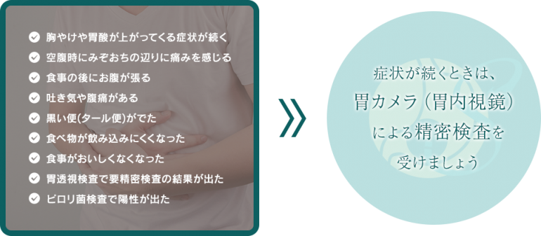 症状が続くときは、胃カメラ（胃内視鏡）による精密検査を受けましょう